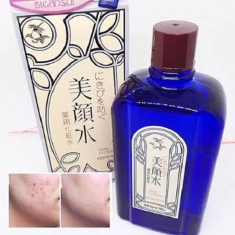 Nước hoa hồng trị mụn meishoku 80ml của Nhật