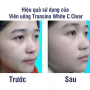 Viên uống Transino White C Clear 120 viên trắng da trị nám