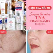 Serum đặc trị nám trắng da TNA Tranesamix Essence Nhật Bản