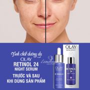 Tinh chất Olay Retinol 24 Night Serum của Mỹ chống lão hóa