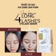 Serum dưỡng mi Long4Lashes Eyelash Serum chai 3ml