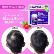 Viên ngậm Natrol Biotin 10000mcg của Mỹ hỗ trợ mọc tóc