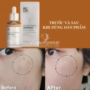 Serum trị nám trắng da Kr.Lab Dark Spot Solution Hàn Quốc 50ml