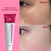 Kem trắng da trị nám Arbutin 5.0 Whitening Cream Tosowoong