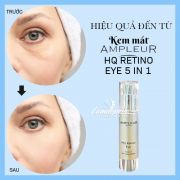 Kem mắt Ampleur 5 in 1 HQ Retino Eye Cream 20g của Nhật Bản