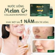 Nước uống Melon G+ Collagen hộp 10 chai x 50ml Nhật Bản