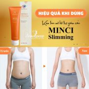 Kem tan mỡ bụng Minci Slimming tuýp 150g cải thiện vóc dáng