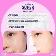 Mặt nạ dưỡng trắng Super Glutathione 100 Bright Mask Sur.Medic